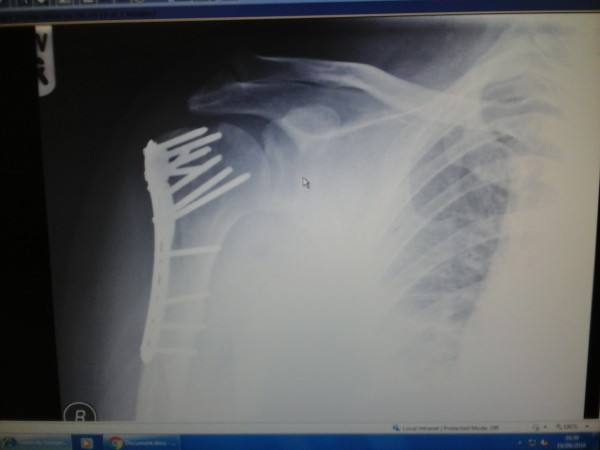 Shoulder Plate.jpg